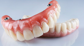 All-on-4 dentures have their own special care requirements