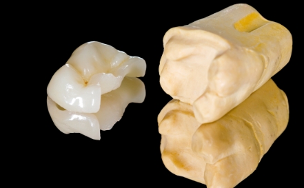 Model tooth with metal free dental crown