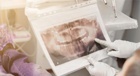 a patient looking at an X-ray of their teeth